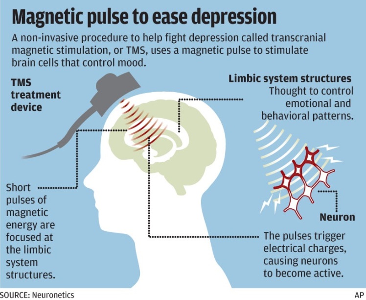 magnetic-healing-depression image